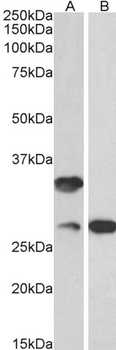 Slc5a1 Antibody