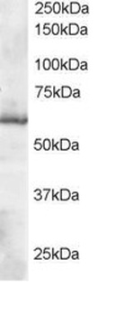 Thioredoxin Reductase 1 Antibody