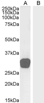 TGIF2 Antibody