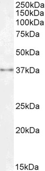 Sprouty Antibody