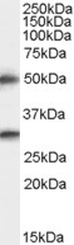 Spinesin Antibody