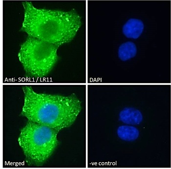 SORL1 Antibody