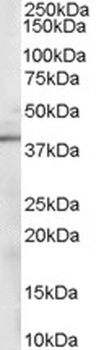 Sorbitol Dehydrogenase Antibody