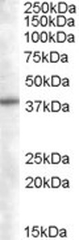 SNX16 Antibody