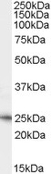 SMEK1 Antibody