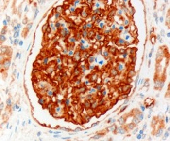 SLC9A3R2 Antibody