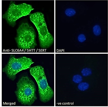 SLC6A4 Antibody