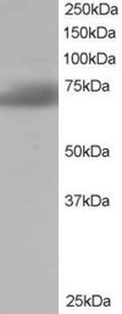 SH3BP1 Antibody