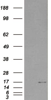 SH2D1A Antibody