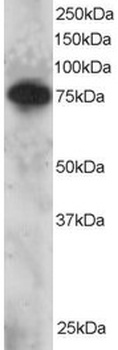 SETMAR Antibody