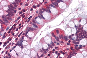 Serotonin receptor 3A Antibody