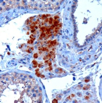 SECISBP2 Antibody