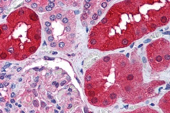 RNF213 Antibody