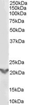 Rhophilin 2 Antibody
