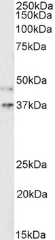 Renin Receptor Antibody