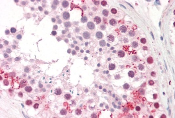 PUM2 Antibody