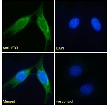 PTCH Antibody