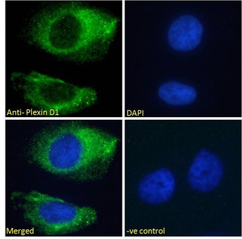 Plexin D1 Antibody