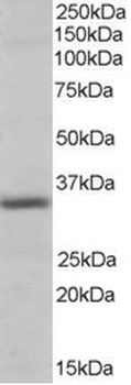Pirin Antibody