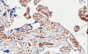 PIK3C2A Antibody