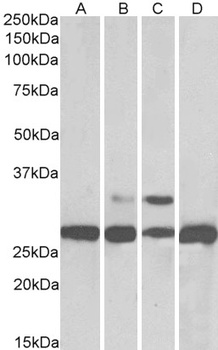 PGAM1/PGAM2/PGAM4 Antibody