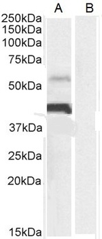 PD-L1 Antibody