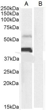 CD274 Antibody