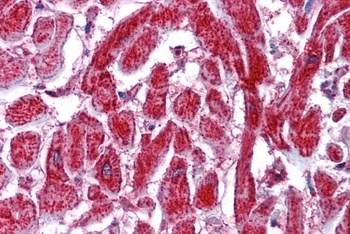 PDIA2 Antibody