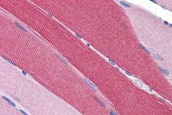 PDE4D Antibody