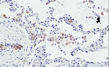 PDE11A Antibody