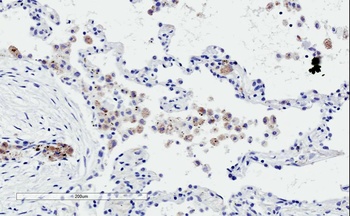 PDE11A Antibody