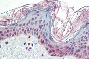 PARP2 Antibody