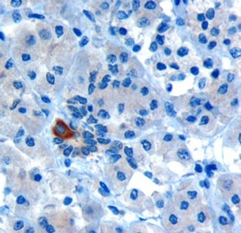 PAR6 alpha Antibody