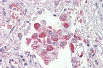 OSBPL9 Antibody