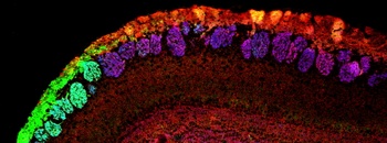 NCAM2 Antibody