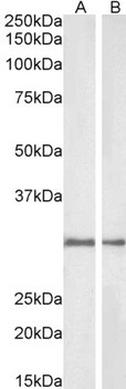 NQO1 Antibody