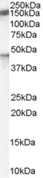 NMDA Receptor Antibody