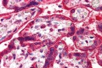 NEIL1 Antibody