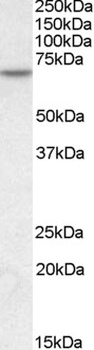 MTM1 Antibody