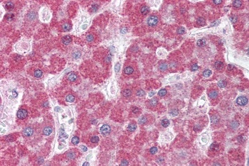 MRP5 Antibody