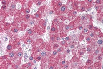 ABCC5 Antibody