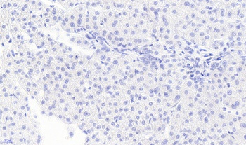 Monoglyceride Lipase Antibody