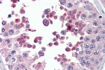MLL4 Antibody