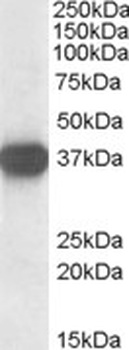 Melanocortin 3 Receptor Antibody