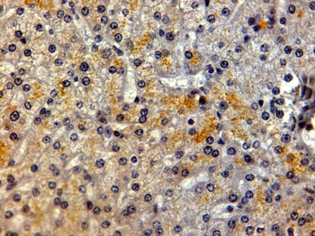 LRP5 Antibody