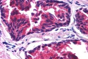 Lipin 3 Antibody