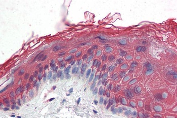 ITPR2 Antibody