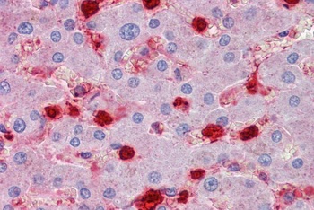 S100A9 Antibody