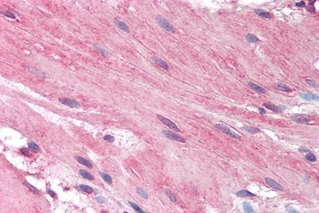 Histamine Receptor H1 Antibody