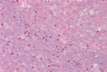 GRIPAP1 Antibody